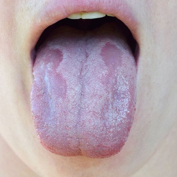 Con saltar Odio Atento a tu lengua y lo que dice de tu salud
